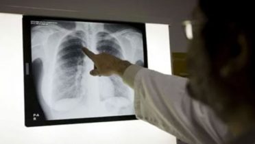 Nueva vacuna contra la tuberculosis