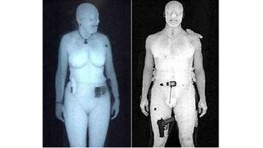 Escáner corporal: 10 preguntas, 10 respuestas