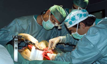 Operación quirúrgica de un tranplante.