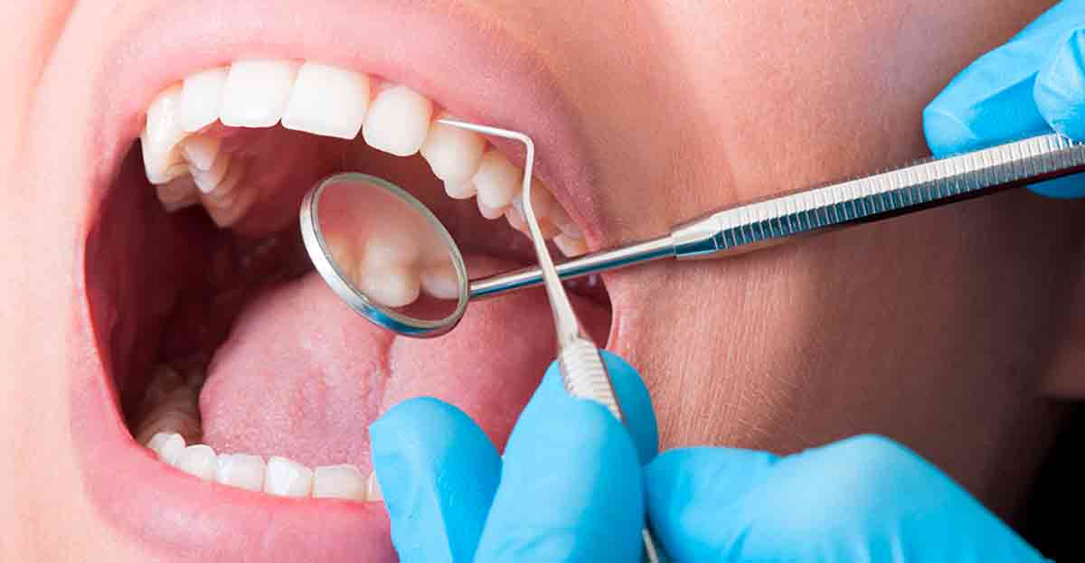 La diabetes provoca periodontitis en las encías