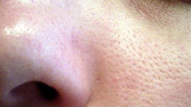 12 trucos para eliminar poros abiertos e imperfecciones.