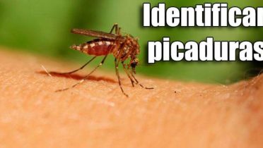Cómo identificar una picadura y saber qué insecto es - Los 8 más comunes