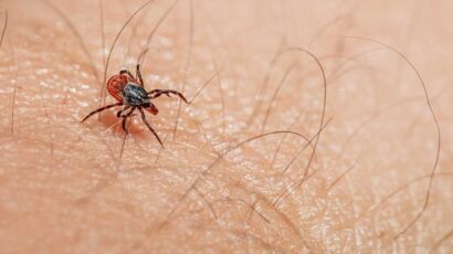 La picadura de insectos en verano es muy común.