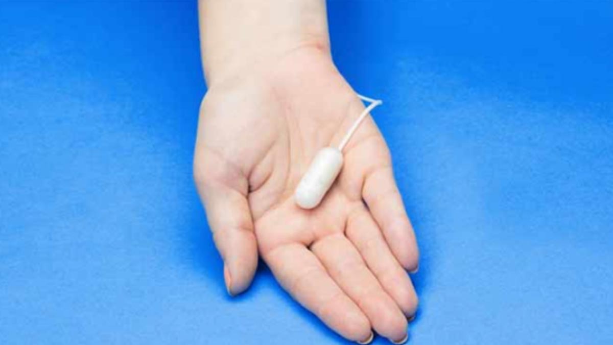 Figura de balón gástrico