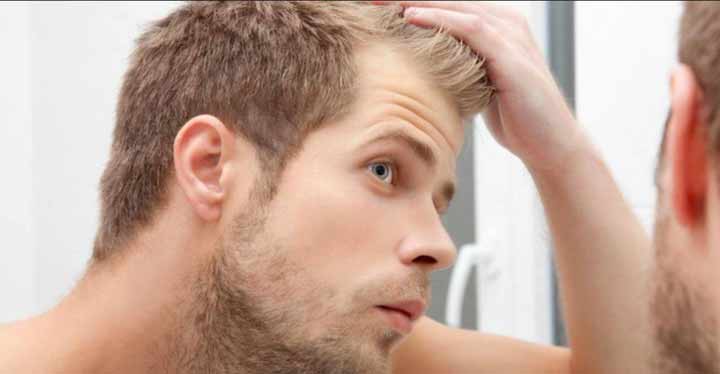 Hombre mirándose las entradas de la cabeza