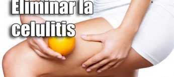 Cómo eliminar la celulitis de piernas y glúteos