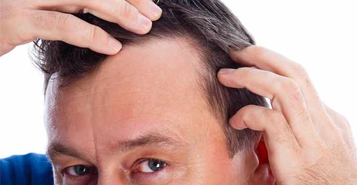 Hombre viendo las entradas de la cabeza