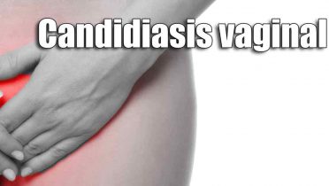 Síntomas y tratamiento para la candidiasis vaginal
