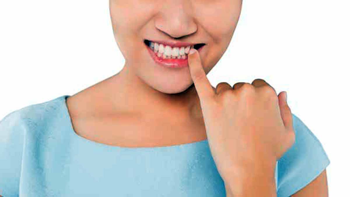 Retracción de encías