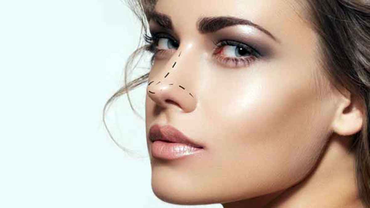 Tipos de rinoplastia