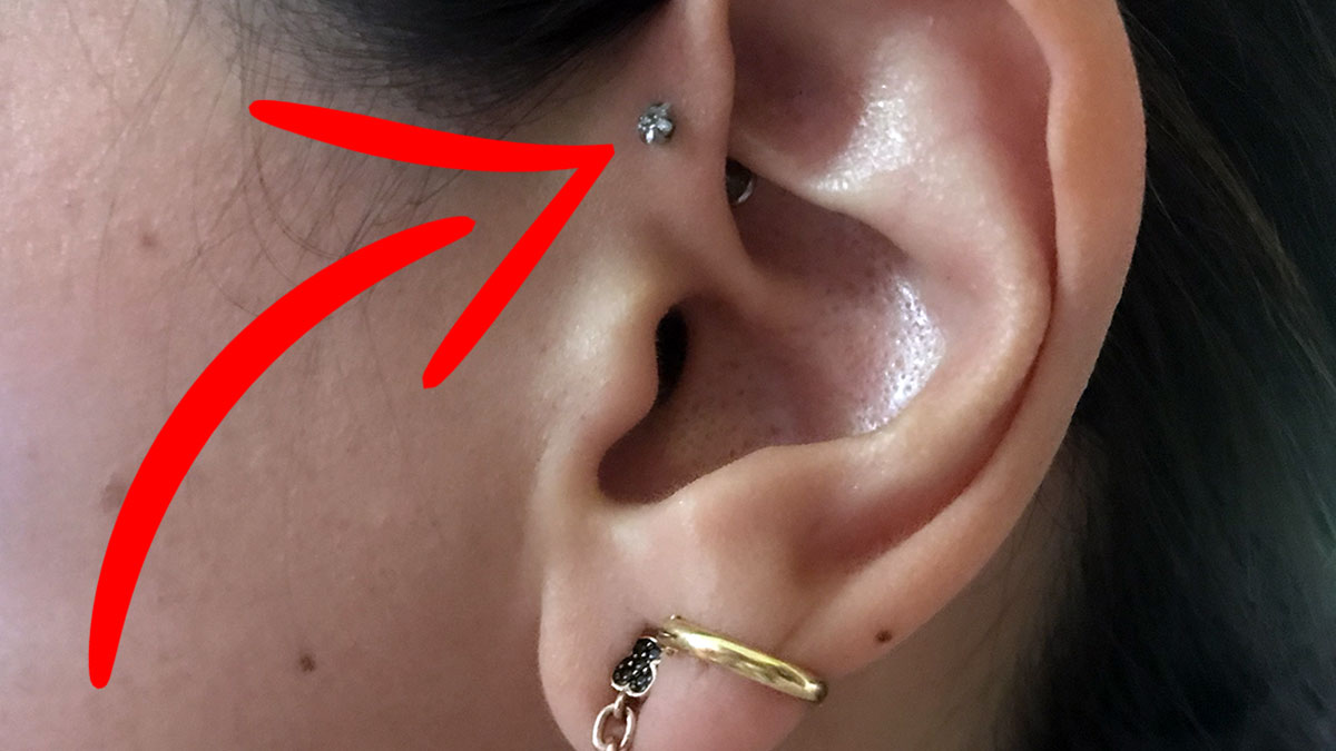 Pendiente contrahélix