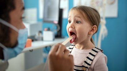 Por qué salen las placas en la garganta y cómo tratarlas