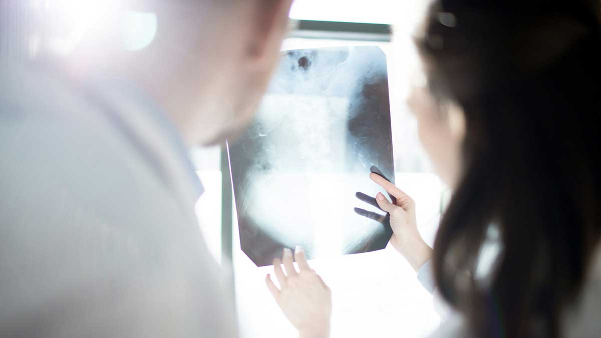 Error al leer una radiografía derivó en cirugía: la paciente recibirá una indemnización de casi 12.000 euros